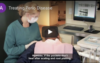 Treating Perio Disease