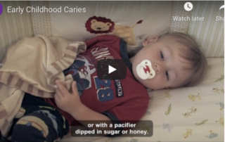 Early childhood caries