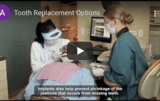 Tooth replacement options